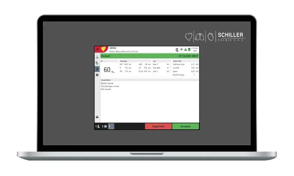Logiciel d'interprétation pour ECG Cardiovit FT-1