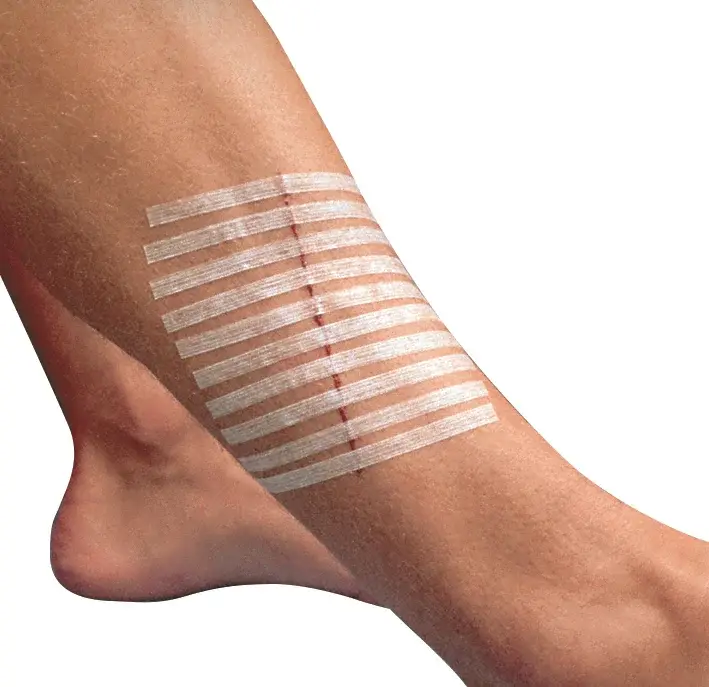 Suture adhésive cutanée 3M Steri-Strip stérile