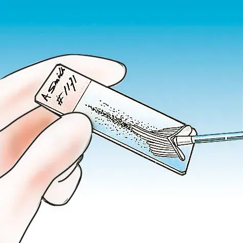 Brosse à prélèvement Cervex Brush®