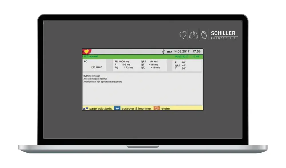 Logiciel d'interprétation ETM pour ECG Cardiovit AT1 G2