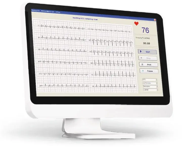 ECG 12 pistes Edan SE-1515