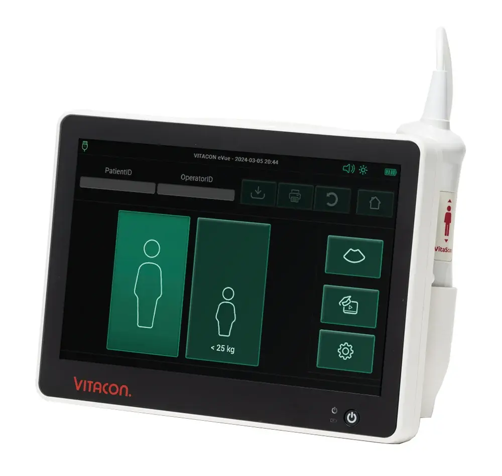Bladder scanner Vitascan
