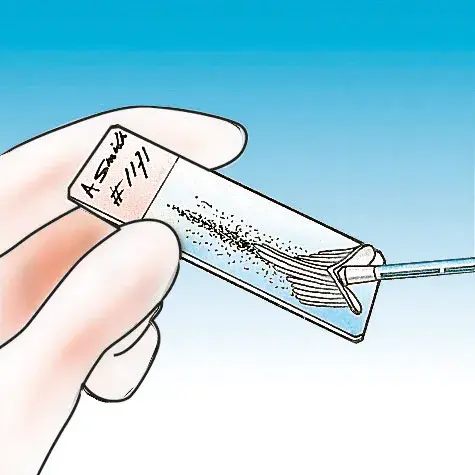 Brosse à prélèvement Cervex Brush®