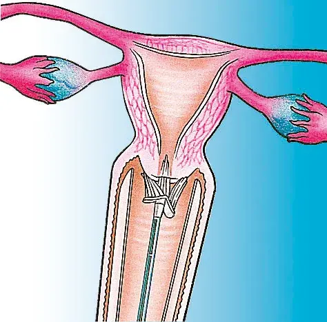 Brosse à prélèvement Cervex Brush®