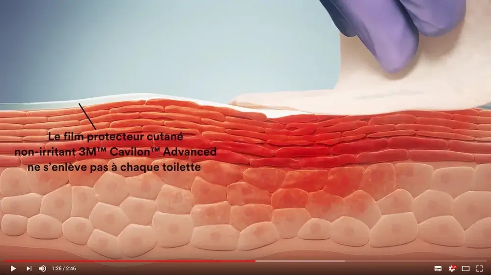 Film protecteur cutané haute résistance 3M Cavilon Advanced