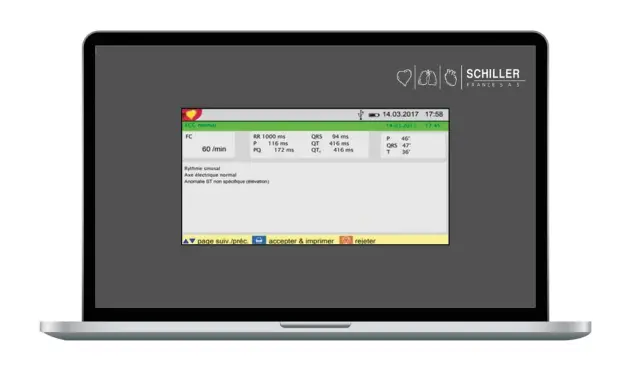 Produit Logiciel d'interprétation ETM pour ECG Cardiovit AT1 G2 Image