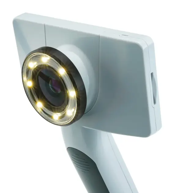 Produit Lentille pour caméra médicale RCS-100 Image