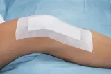 Vignette - Pansement stérile adhésif avec compresse non adhérente 3M Medipore + Pad