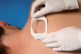 Vignette - Pansement stérile 3M Tegaderm