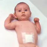 Vignette - Sparadrap microporeux 3M Micropore