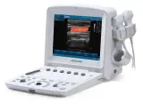 Vignette - Échographe portable couleur U50