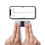 Vignette - ECG Kardia Mobile 1L