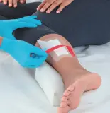 Vignette - Pansement adhésif transparent stérile Leukomed® T Plus